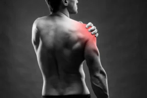 Nutrition and Supplements